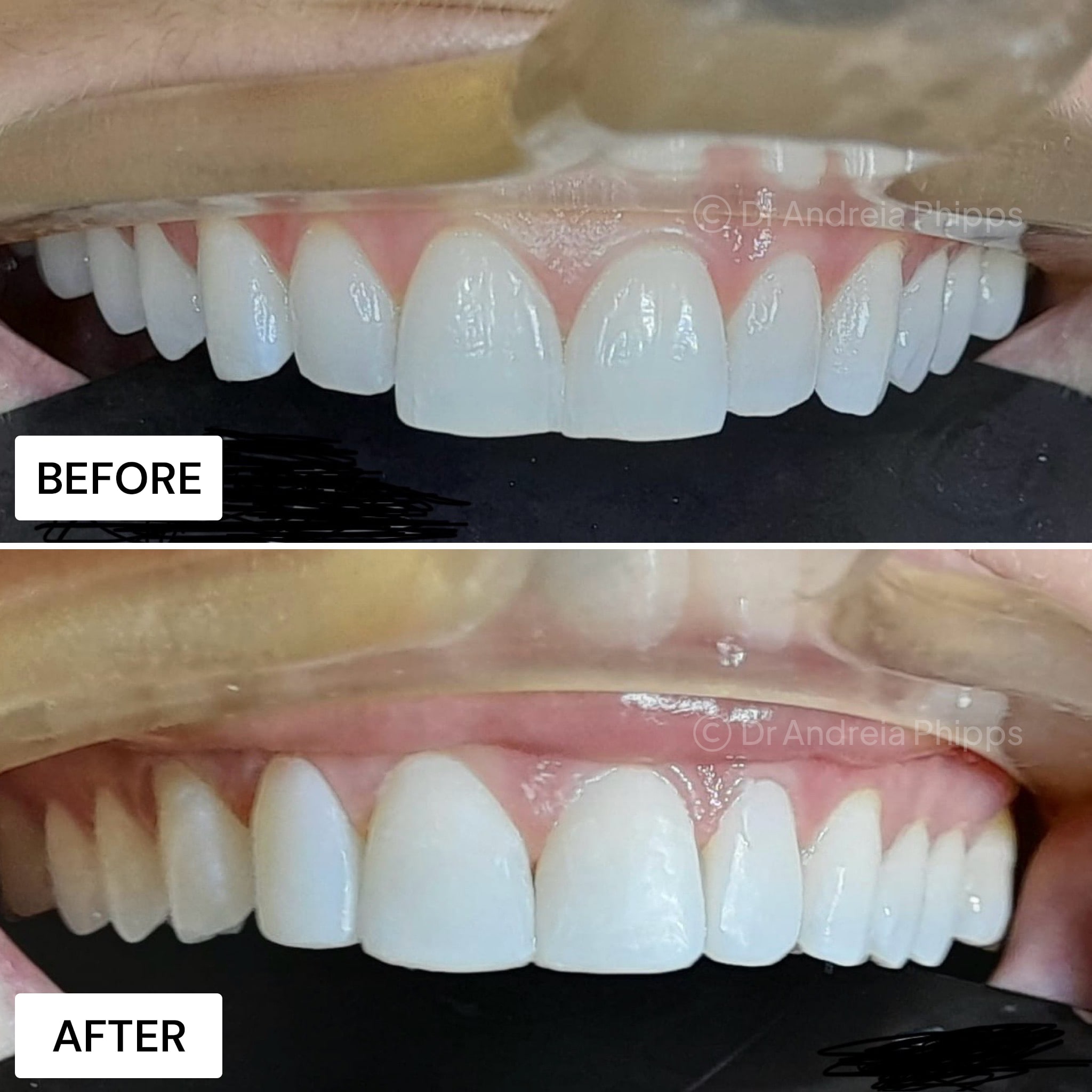Transformation Case 7