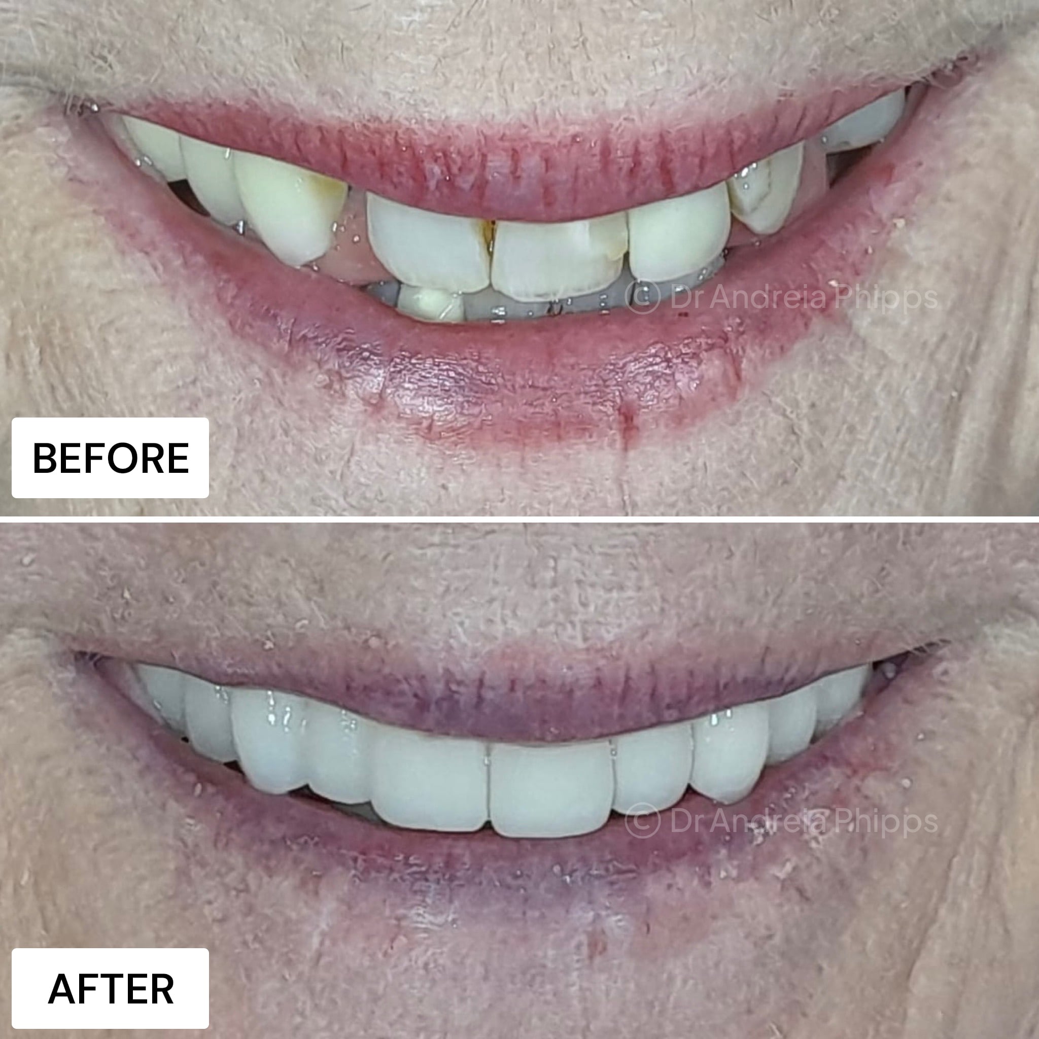 Transformation Case 6