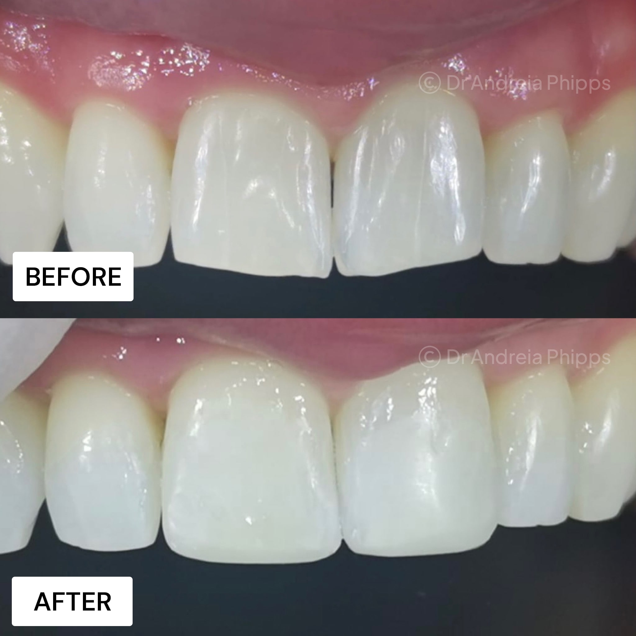 Transformation Case 5