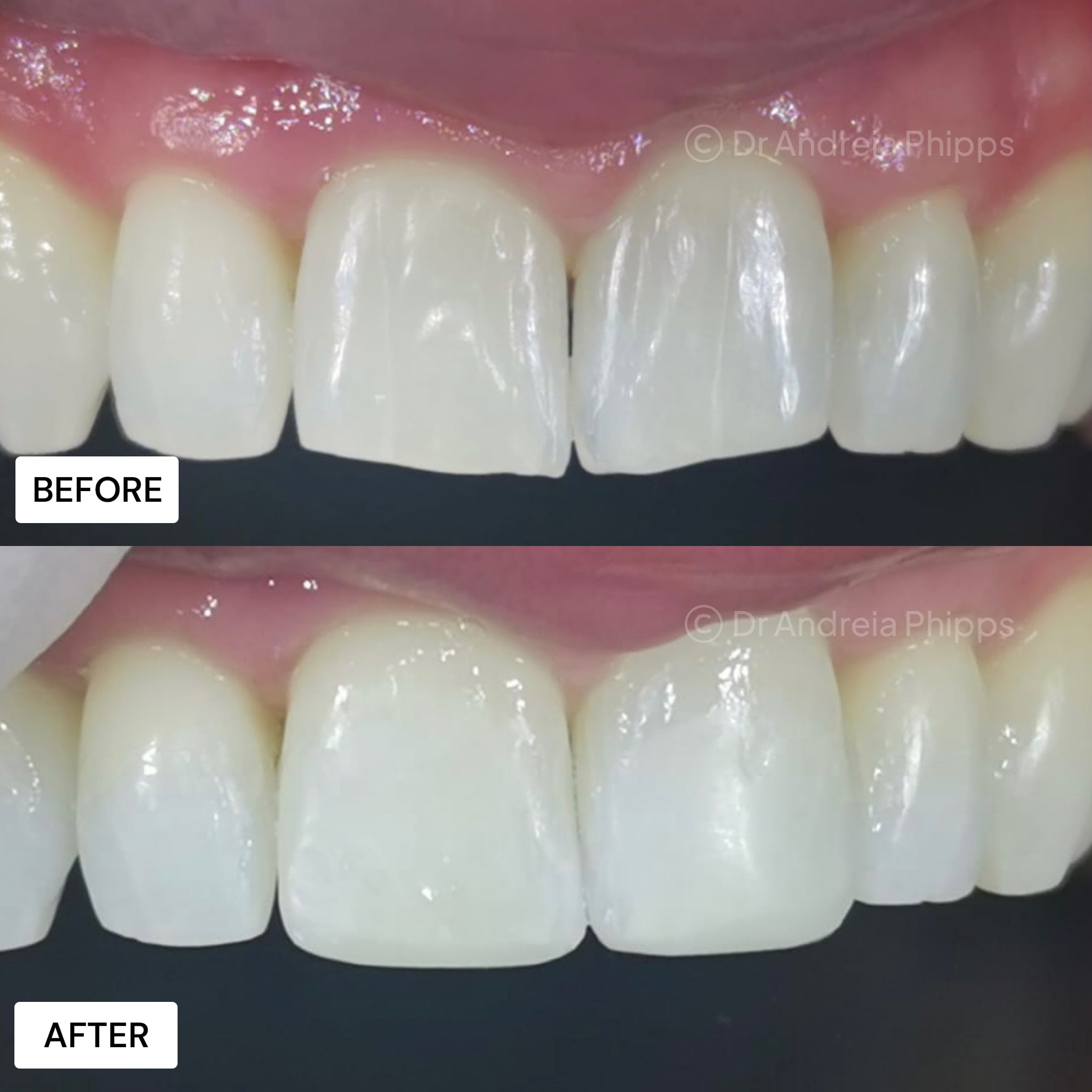 Transformation Case 4
