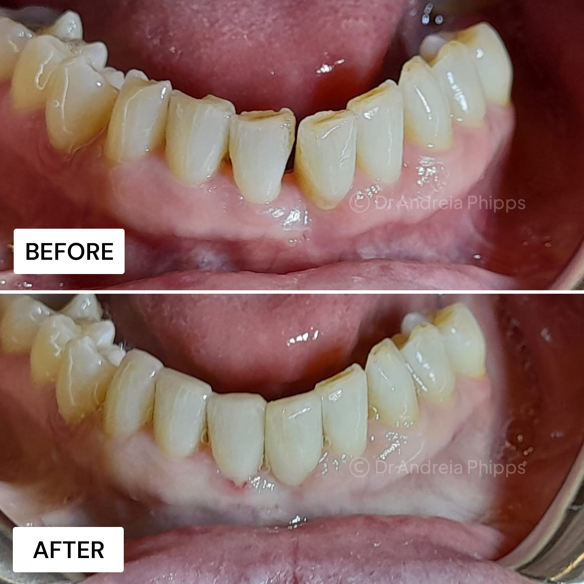 Transformation Case 2