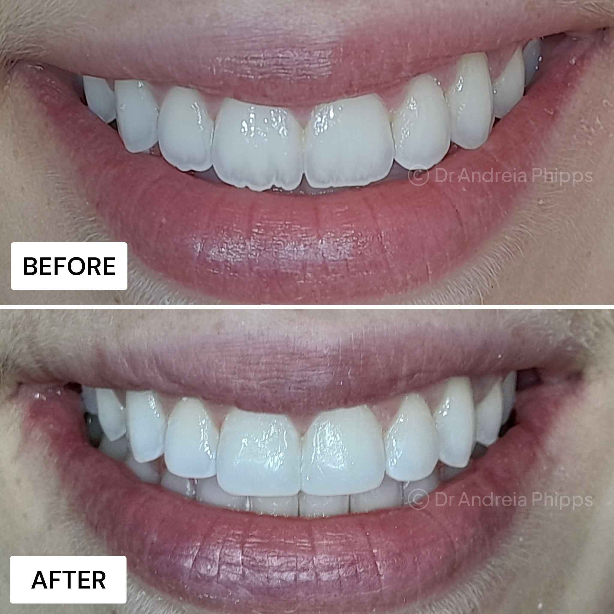 Transformation Case 1