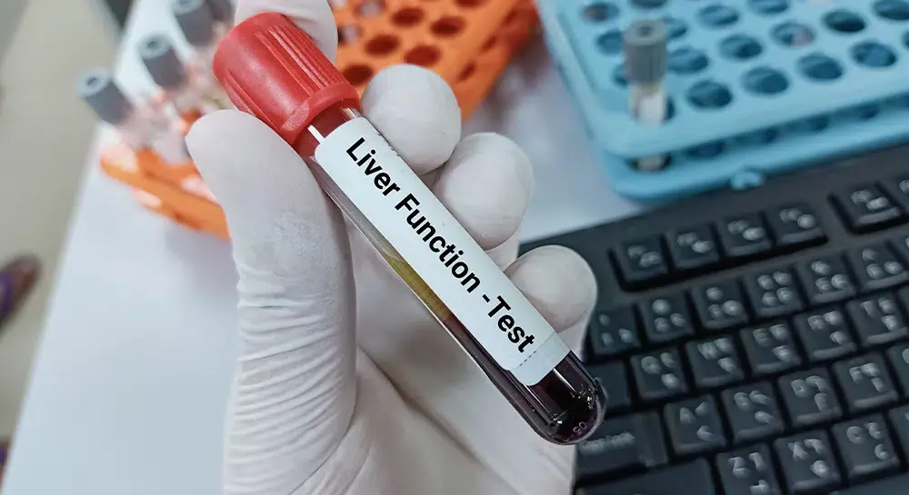 Do You Need a Liver Function Test? Key Signs | Private Blood Tests London