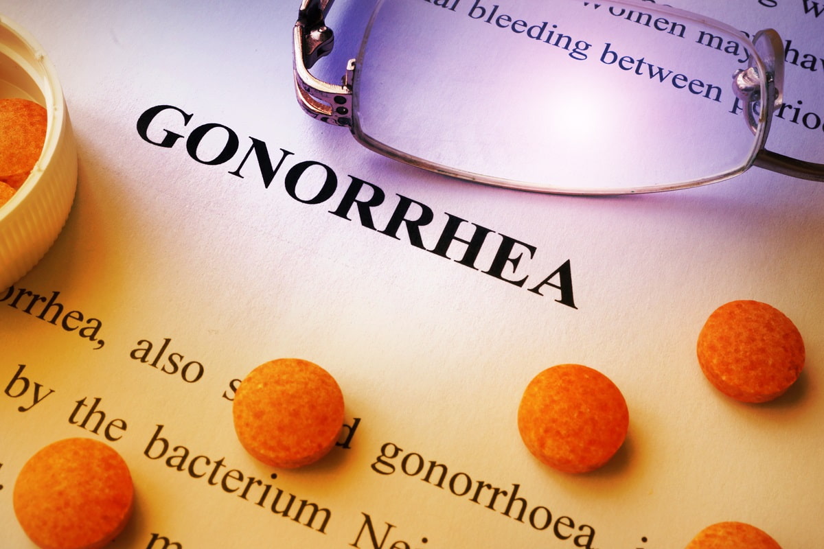 Everything You Need to Know About Gonorrhoea