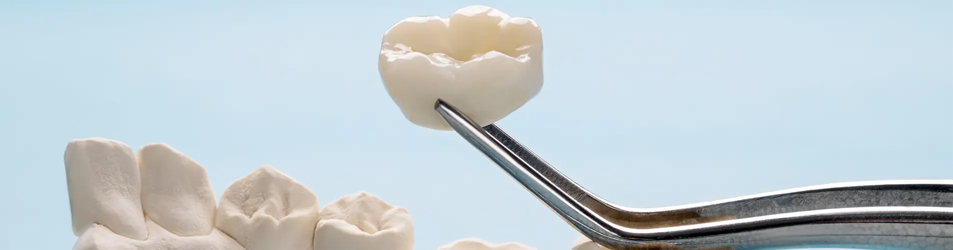 Why Zirconia Crowns Are Becoming the Gold Standard