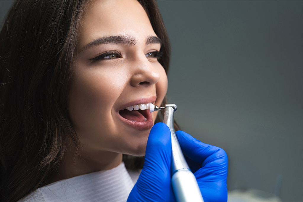 Professional Dental Cleaning in London: How Often Should You Have It?