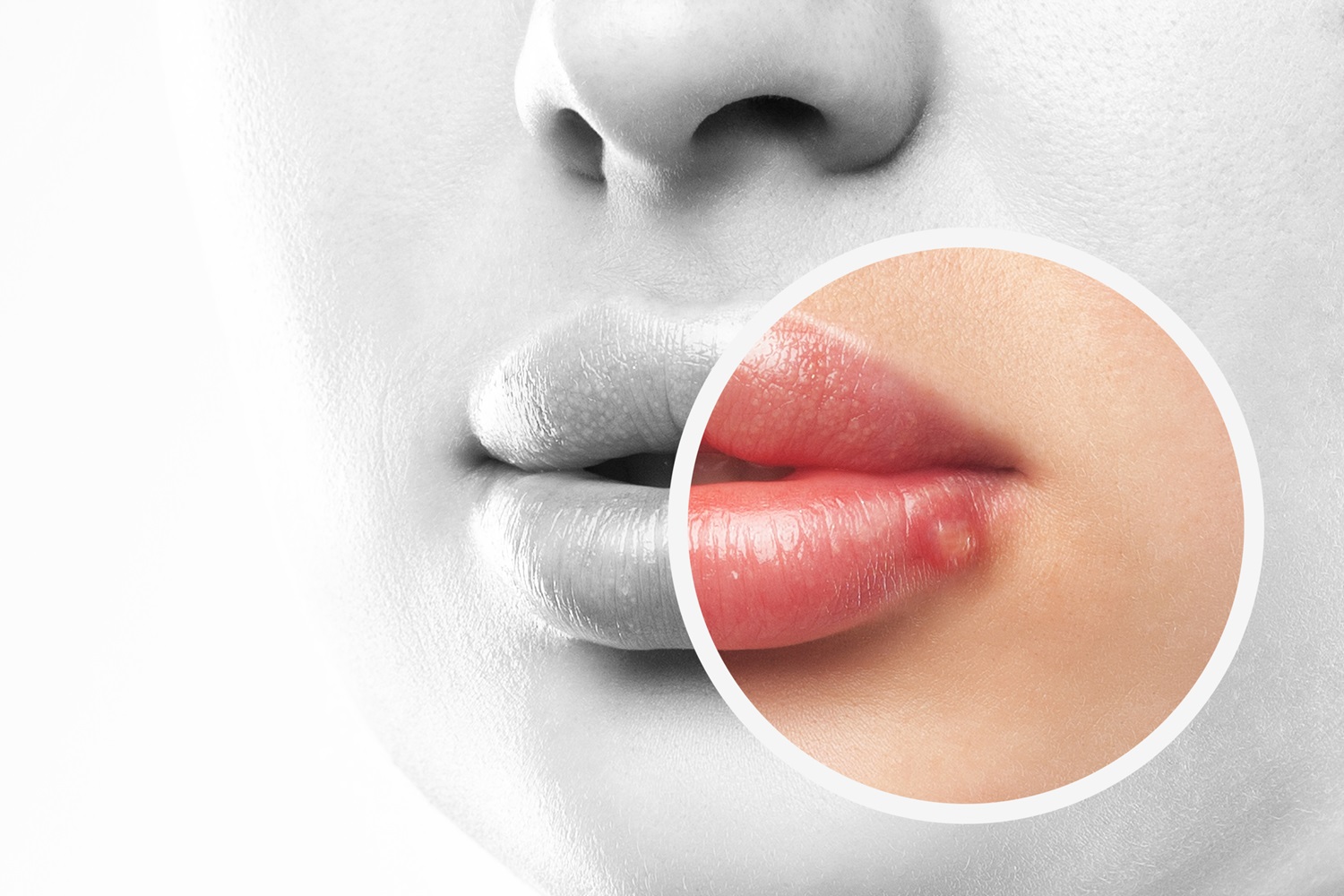 The Silent Epidemic: How Widespread Is Herpes in Britain?