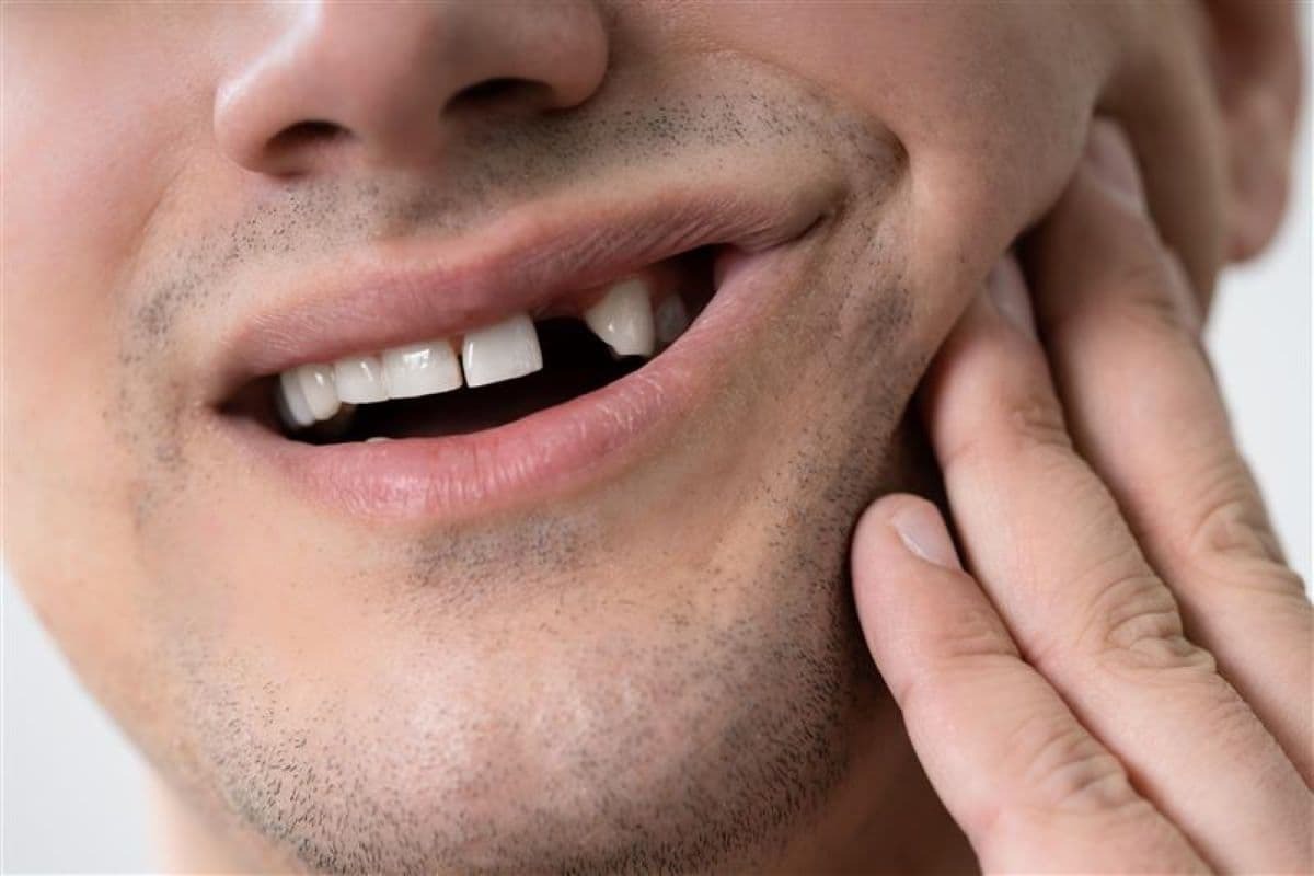 The 'Gap' Effect: What Happens If You Do Nothing About a Missing Tooth