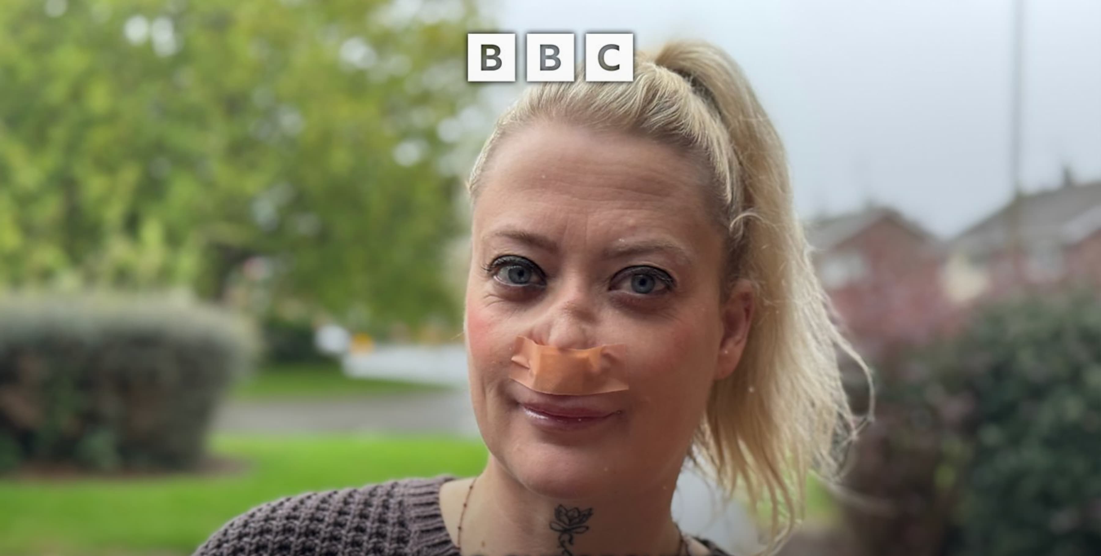 Turkey Teeth Gone Wrong: The Real Risks of Dental Treatment Abroad