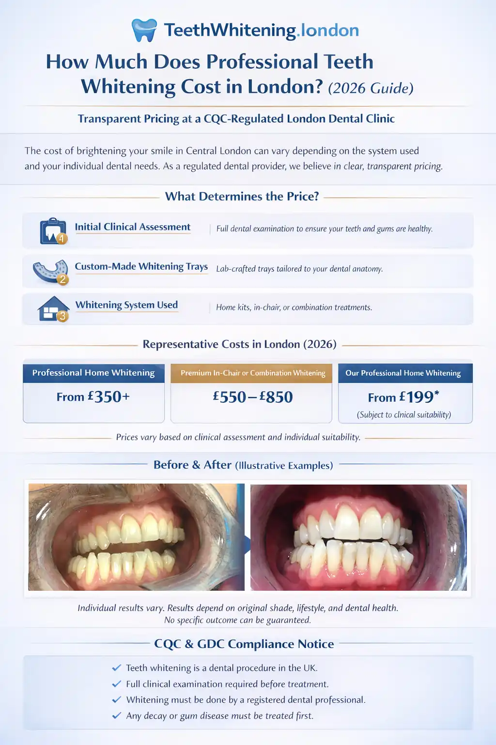 Infographic comparing teeth whitening costs in London - home kits from £199, in-chair £400-800, combination treatments £550-850