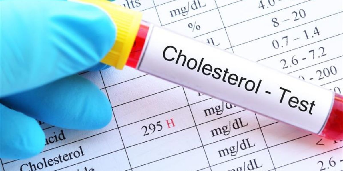 A Clinical Guide to Lipid and Cholesterol Blood Test Interpretation ...