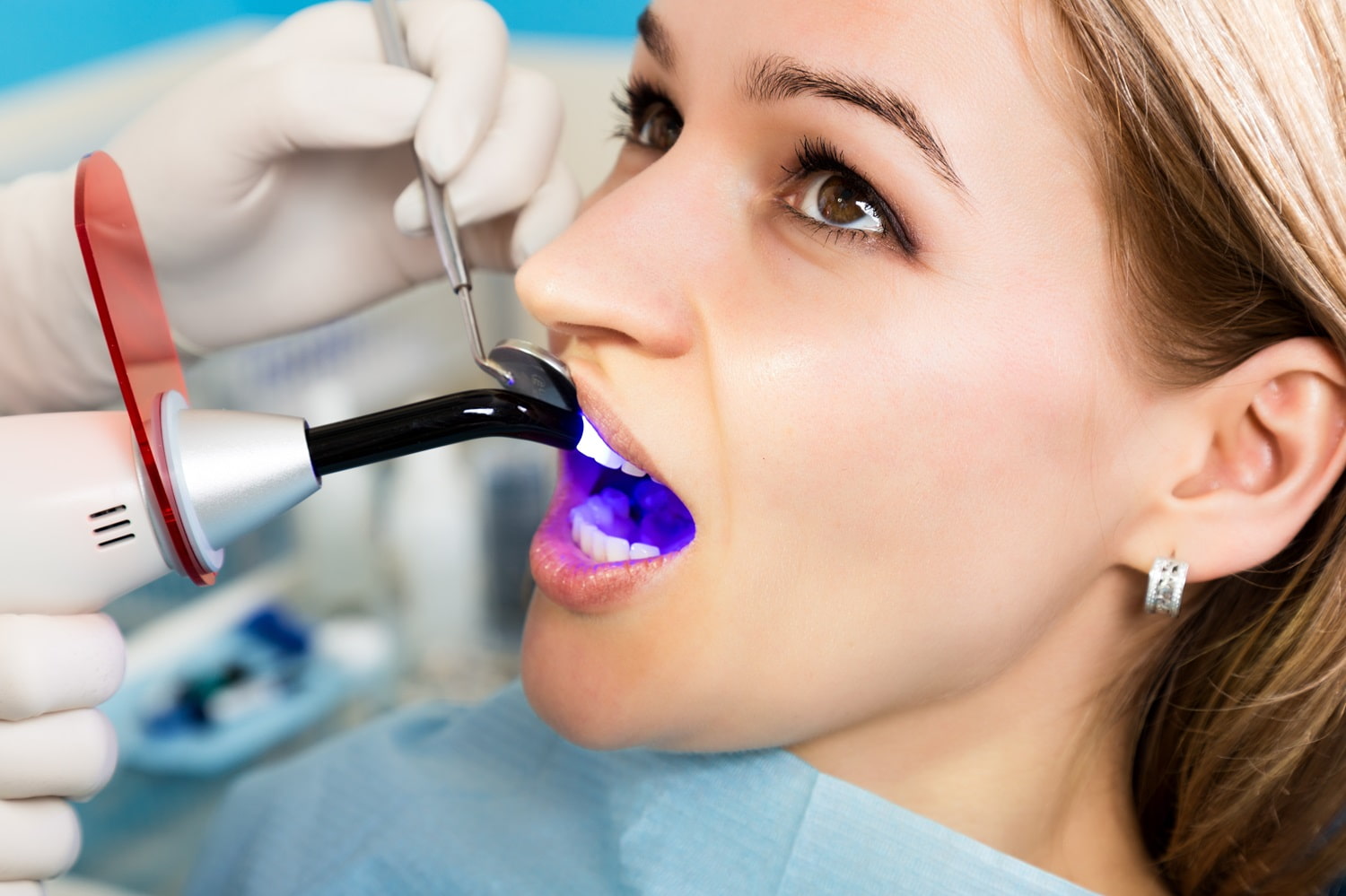 Do Fillings Hurt? What to Expect During and After a Cavity Filling