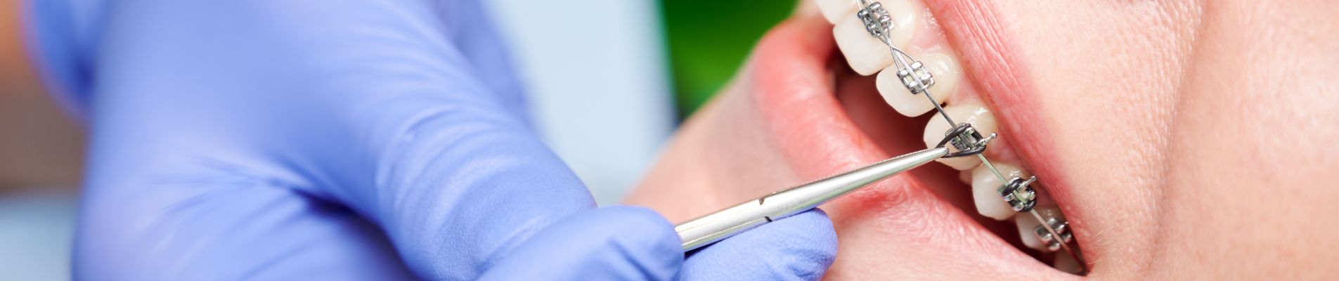 What to Do If You Swallow a Brace Bracket: A Step-by-Step Safety Guide