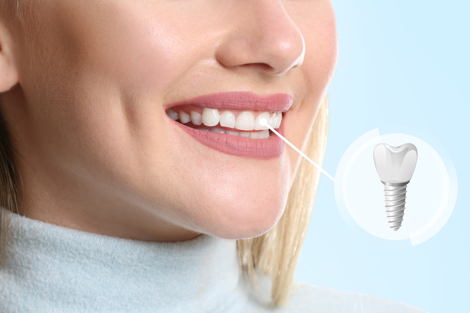 Dental Implants vs Mini Implants: What’s the Difference?