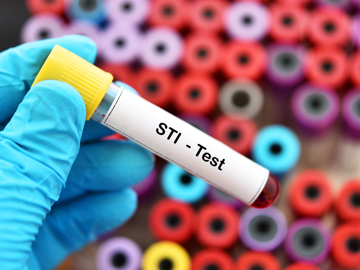 How Much Does Private STI Testing Cost in the UK?