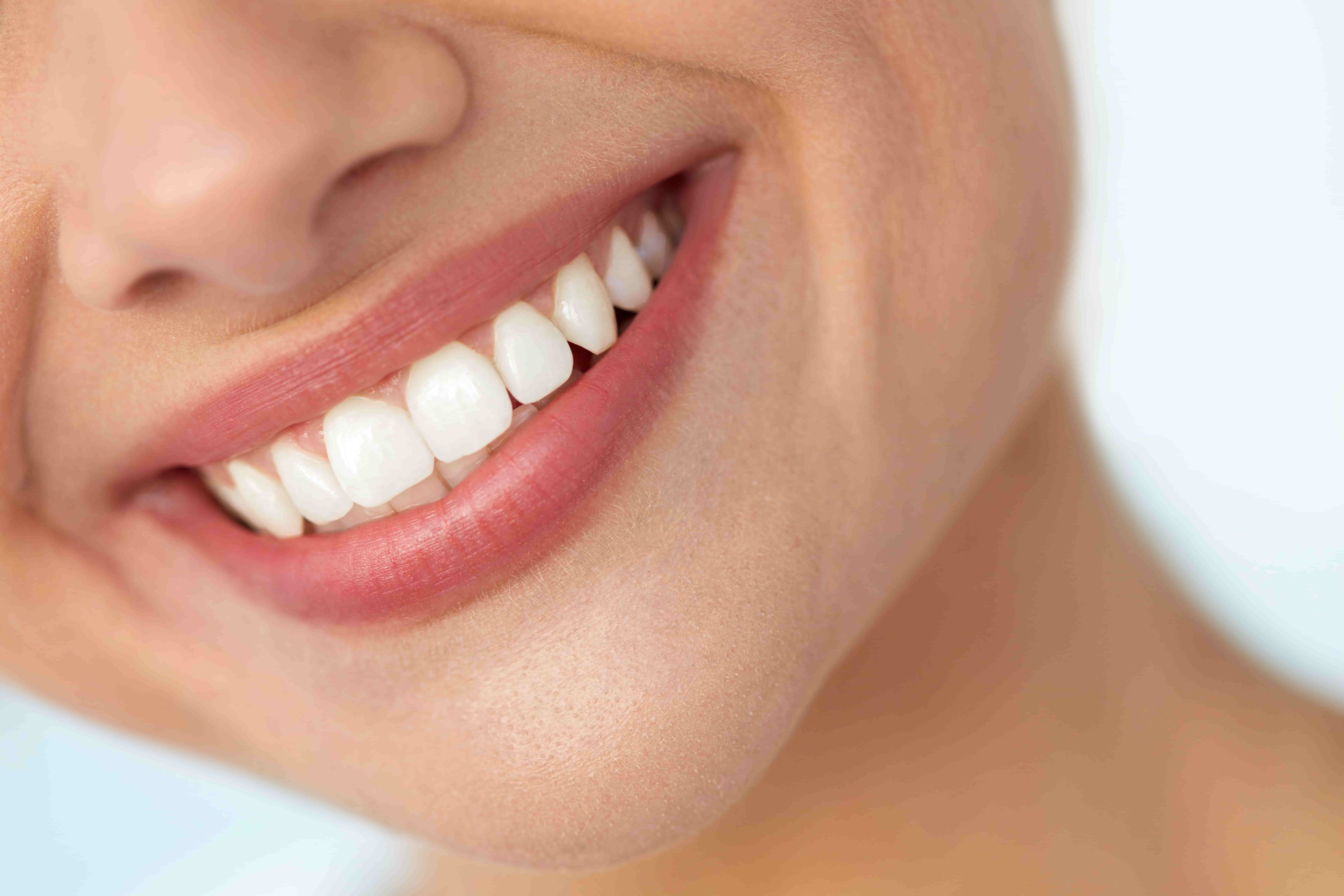 Porcelain vs Composite Veneers: Longevity and Maintenance Compared