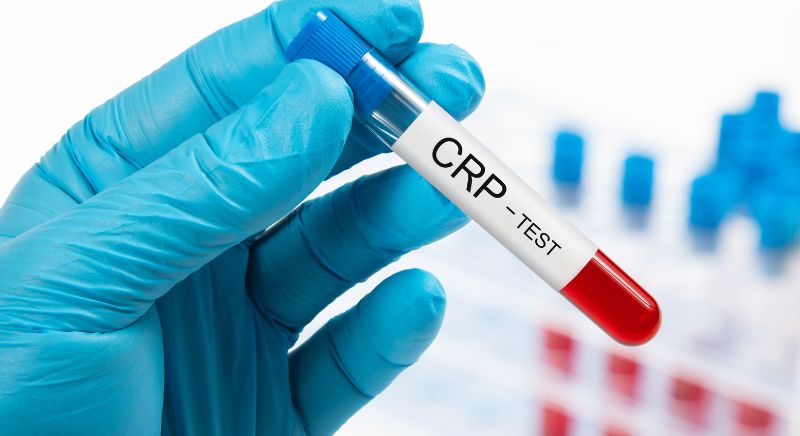 CRP Blood Test Explained | C-Reactive Protein & Inflammation Markers ...
