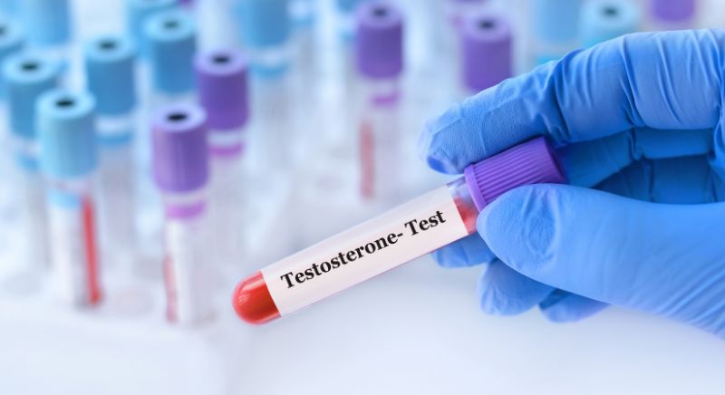 testosterone-blood-test-explained-hormone-health-monitoring-uk