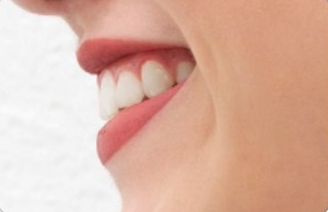 simle