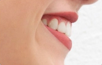simle