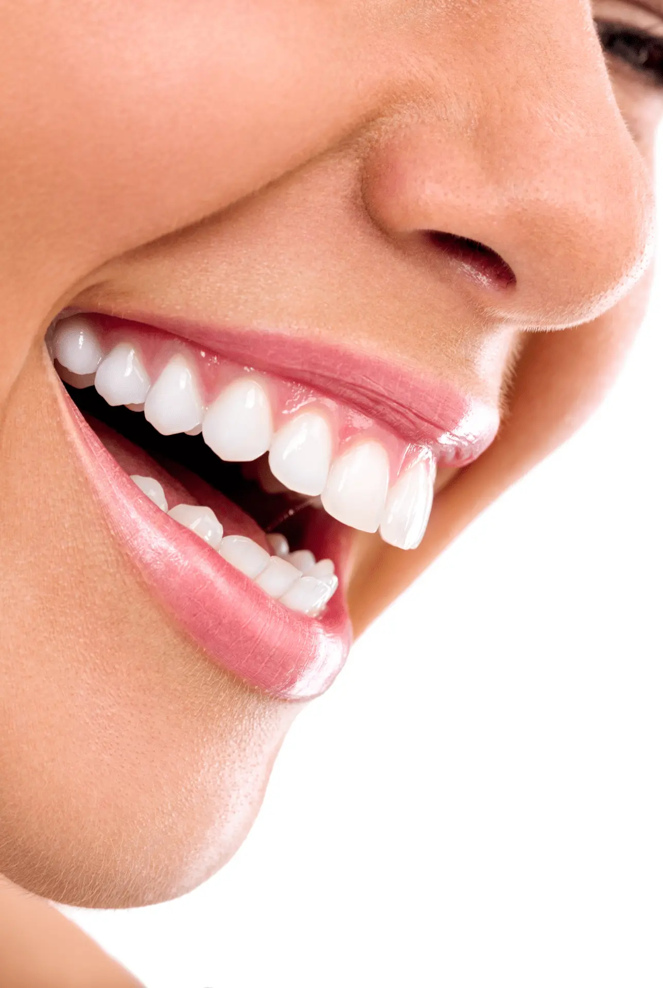 tooth whitening
