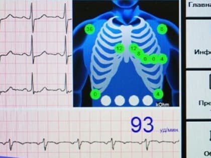 В муромской ЦРБ появилась стресс-система для диагностики заболеваний сердца