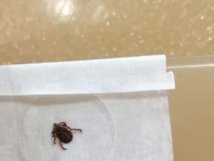 Жителям Владимирской области рассказали, как обезопасить себя от укуса клеща