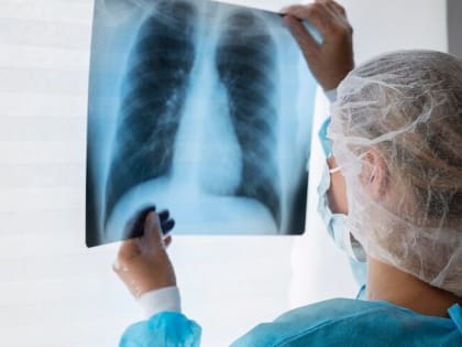 В Александрове больного туберкулезом насильно отправили лечиться