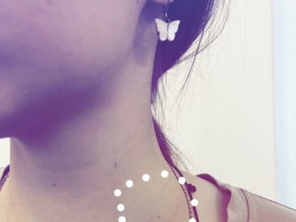 Владимирские врачи выявили редкое онкологическое заболевание у 16-летнего подростка