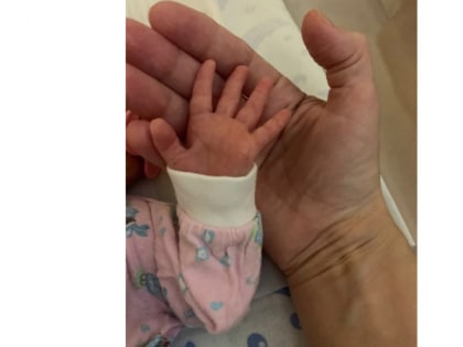 Недоношенного ребенка из Владимирской области отправили на реабилитацию в Москву