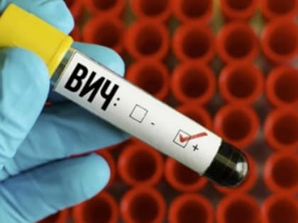 В новосибирском Центре СПИД открыли кабинет ранней диагностики и профилактики туберкулеза