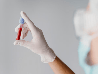 Новосибирцы могут бесплатно тестироваться на ВИЧ и гепатит С