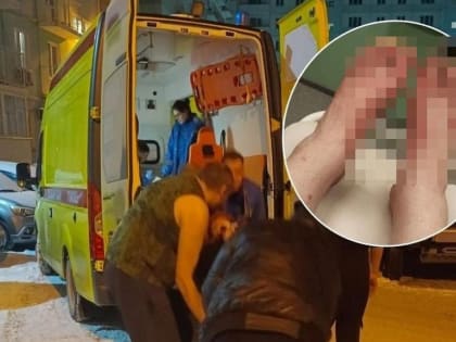 Житель Новосибирска может лишиться пальцев на ногах из-за коммунальной аварии