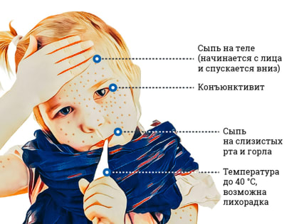 Страшная хворь эта корь