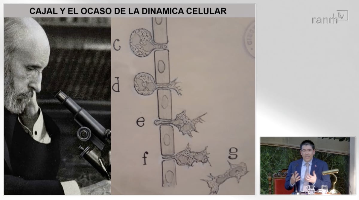 Texturas del microambiente tumoral: José Javier Bravo Cordero