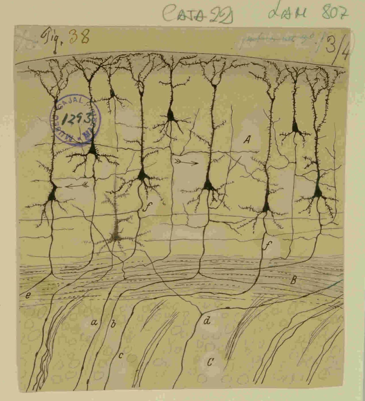 Del Legado de Cajal a la Medicina Respiratoria