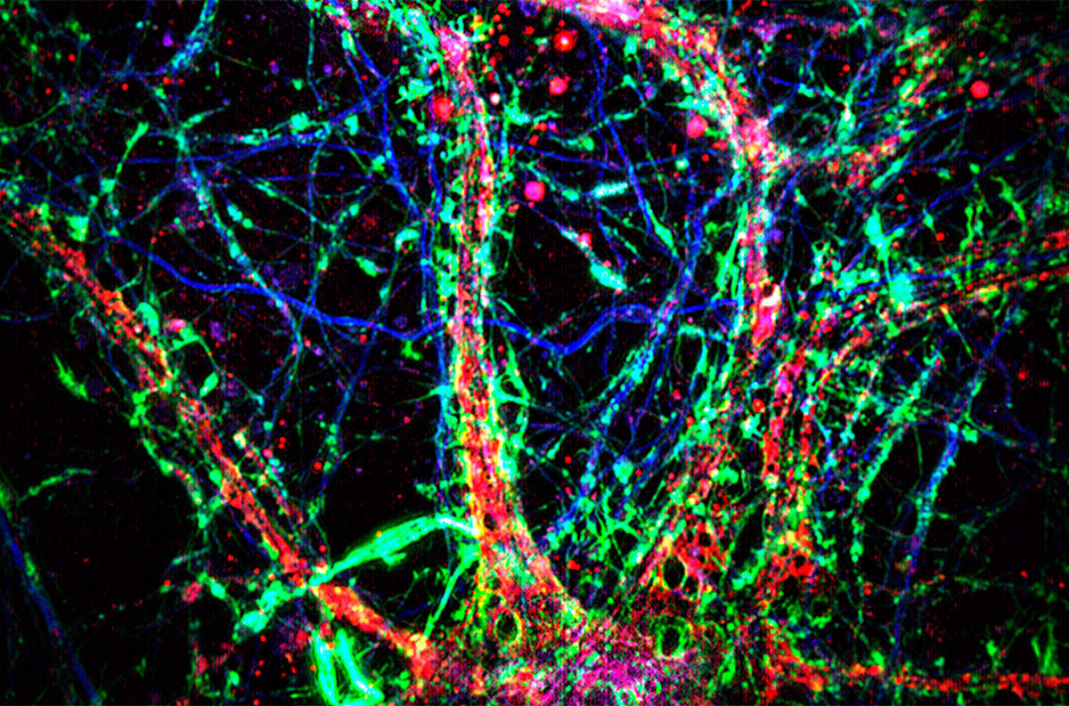 Arte en el Jardín Secreto del Cerebro