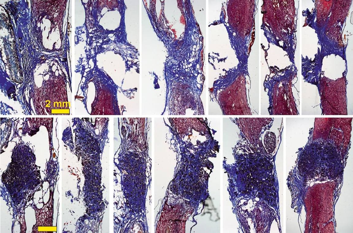 Logran reconectar la médula espinal seccionada de una rata