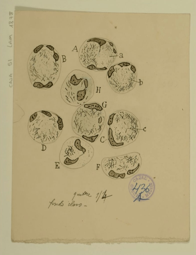 Dibujo científico de E. del Río Lara, leucocitos bacilíferos de sangre de leproso.
