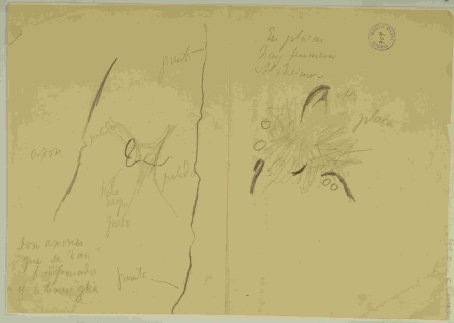 Dibujo científico de Santiago Ramón y Cajal, dos esquemas de estudio: axones transformados, y placa senil tipo Alzheimer. / Santiago Ramón y Cajal.