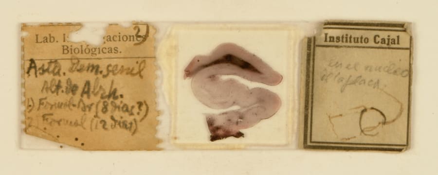 Preparación histológica de Santiago Ramón y Cajal. Alteraciones anatomopatológicas de la formación del hipocampo de un enfermo de Alzheimer: placas seniles, ovillos neurofibrilares, hilos de neurópilo y astrocitos reactivos. Método de óxido de plata amoniacal. Bandeja original "macroglia, hombre y conejo".