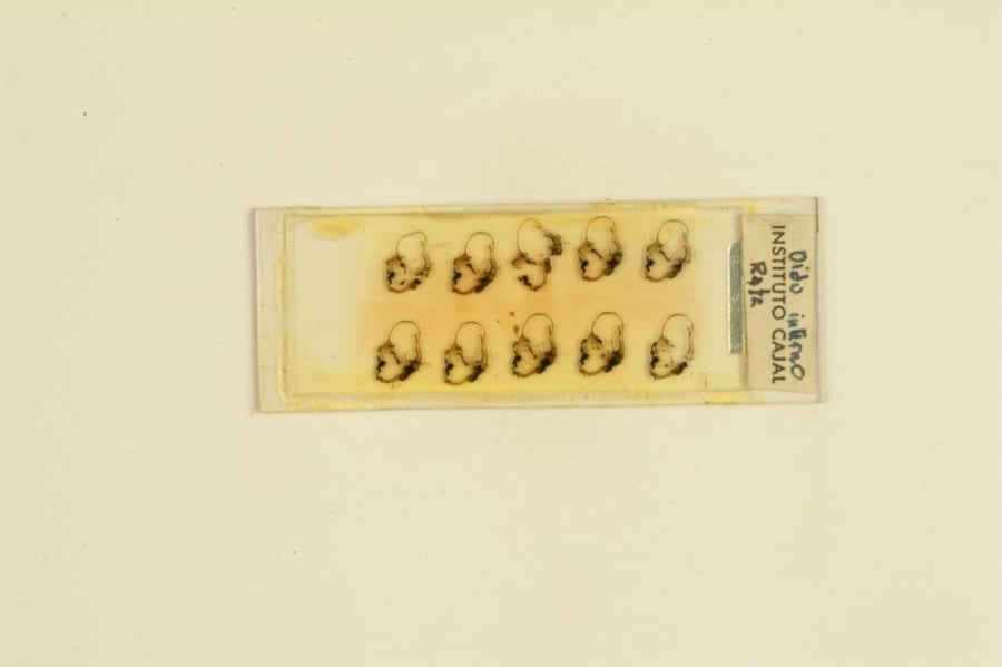 Jorge Francisco Tello - oído de hombre adulto