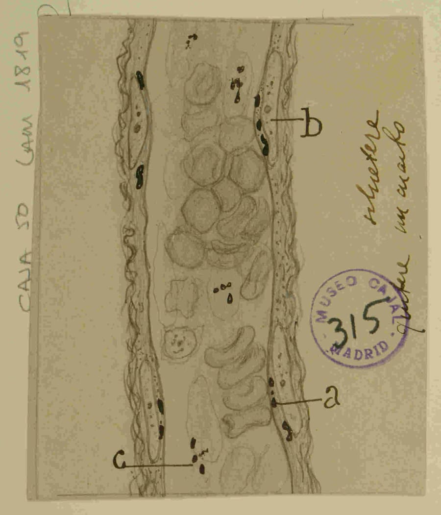 Dibujo científico de un corte histológico, mostrando una sección de tejido con células y estructuras celulares identificadas, usado para ilustrar conceptos en biología y patología.