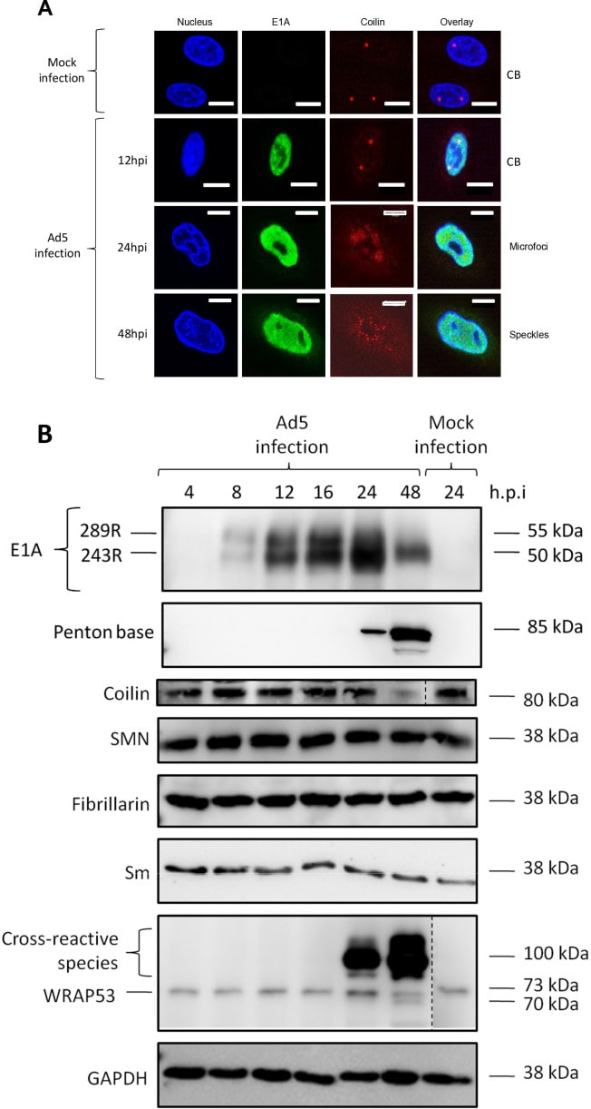 Figura 6: El secuestro del Cuerpo de Cajal por el Adenovirus 5 (Ad5). (A) Imágenes de inmunofluorescencia que muestran la reorganización de la proteína coilina (rojo) en células infectadas. En las células no infectadas (Mock), la coilina se concentra en Cuerpos de Cajal (CBs) definidos. Tras la infección por Ad5, los CBs se desmantelan y la coilina se redistribuye en "microfocos" y "speckles" en la fase tardía (48 hpi). (B) Western blot que confirma que los niveles de las principales proteínas del CB, como Coilina y SMN, permanecen estables durante la reorganización, demostrando que se trata de un secuestro y no de una degradación. (Crédito: White, L.; Erbay, B.; Blair, G.E. mBio 2023, 14, e01459-e01482. CC BY 4.0)