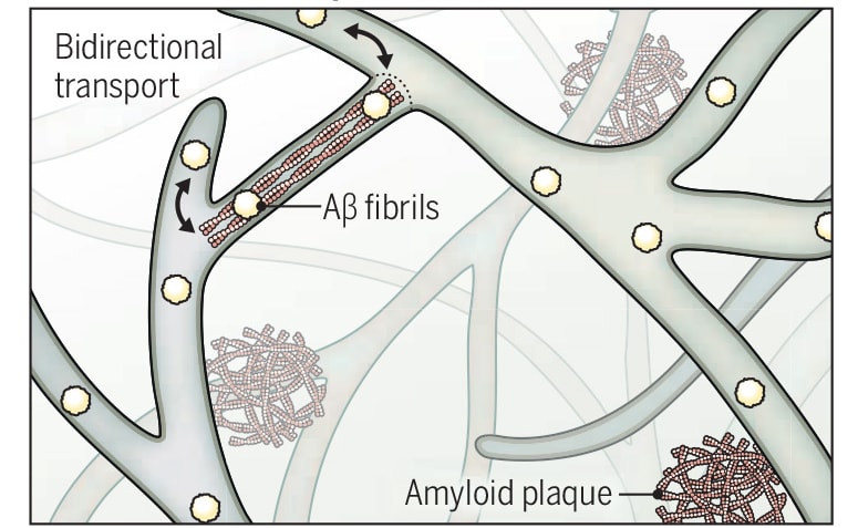 Los DNTs contribuyen a la patología de Aβ en el cerebro con EA (Enfermedad de Alzheimer)