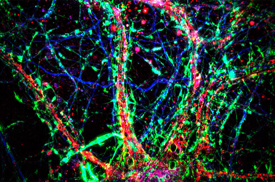 Neuronas y nanotubos. Neuronas en el cerebro del ratón (estructuras celulares en azul y verde, núcleos en magenta) podrían comunicarse entre sí a través de diminutos nanotubos (estructuras verdes delgadas). Minhyeok Chang et al.