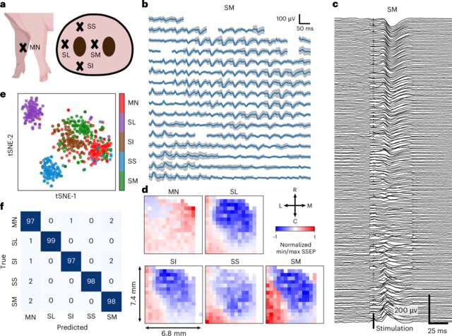 Diagrama que muestra diferentes configuraciones de estimulación en un experimento de neurotecnología, incluyendo trazas de ondas cerebrales y un gráfico de dispersión para compara los movimientos con el pronóstico de una IA.
