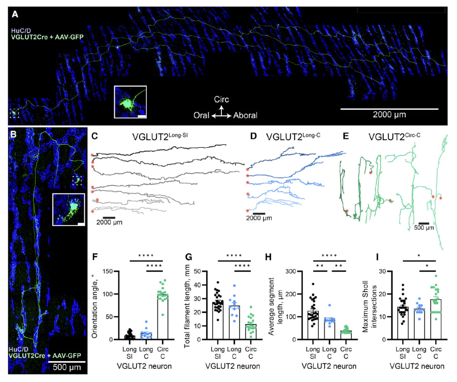 (Microglía y Neurodegeneración): Corresponde a la Figura 2A del estudio de Vicario, Geissmann et al.. Es fundamental para tu artículo porque mapea la expansión de los clones mutantes $BRAF^{V600E}$ en el rombencéfalo (puente y cerebelo) y permite visualizar la diferencia entre la fase incipiente (sin síntomas) y la fase clínica.
