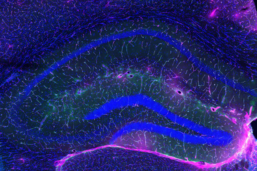 El milagro de la regeneración molecular. Detalle de los vasos sanguíneos de un cerebro envejecido que, tras recibir la acción de la enzima hepática GPLD1, muestran una notable restauración de la integridad vascular, sellando nuevamente el santuario neuronal frente a las toxinas de la sangre. (Crédito: Laboratorio Villeda, UCSF)