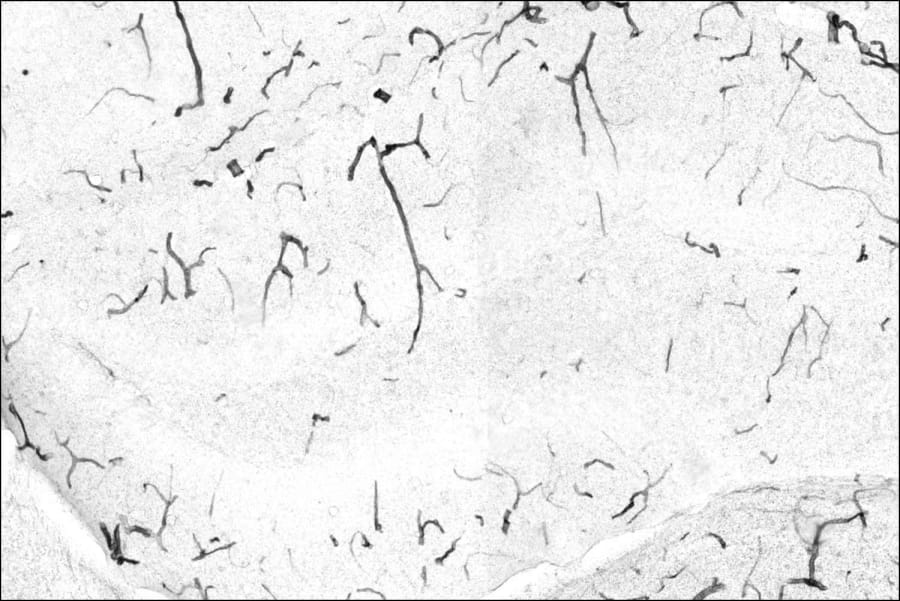 Imagen microscópica que ilustra cómo en un animal envejecido y sedentario, la barrera hematoencefálica se degrada sustancialmente debido a la alta acumulación de proteína TNAP (marcada en negro), lo que permite que una gran cantidad de tinte periférico (rosa) atraviese los vasos sanguíneos y penetre en el parénquima cerebral. (Crédito: Laboratorio Villeda, UCSF) 